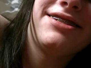 Youthful Teen with Braces